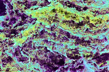 AP 156A1